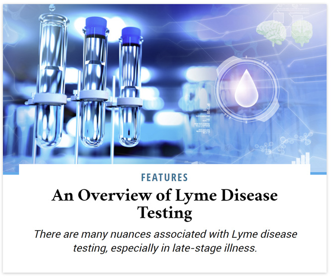 Lyme disease testing