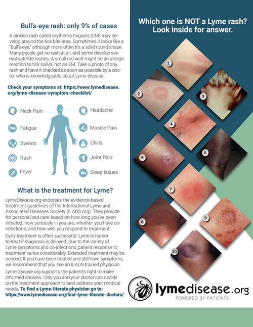 Lyme Disease Facts Brochure