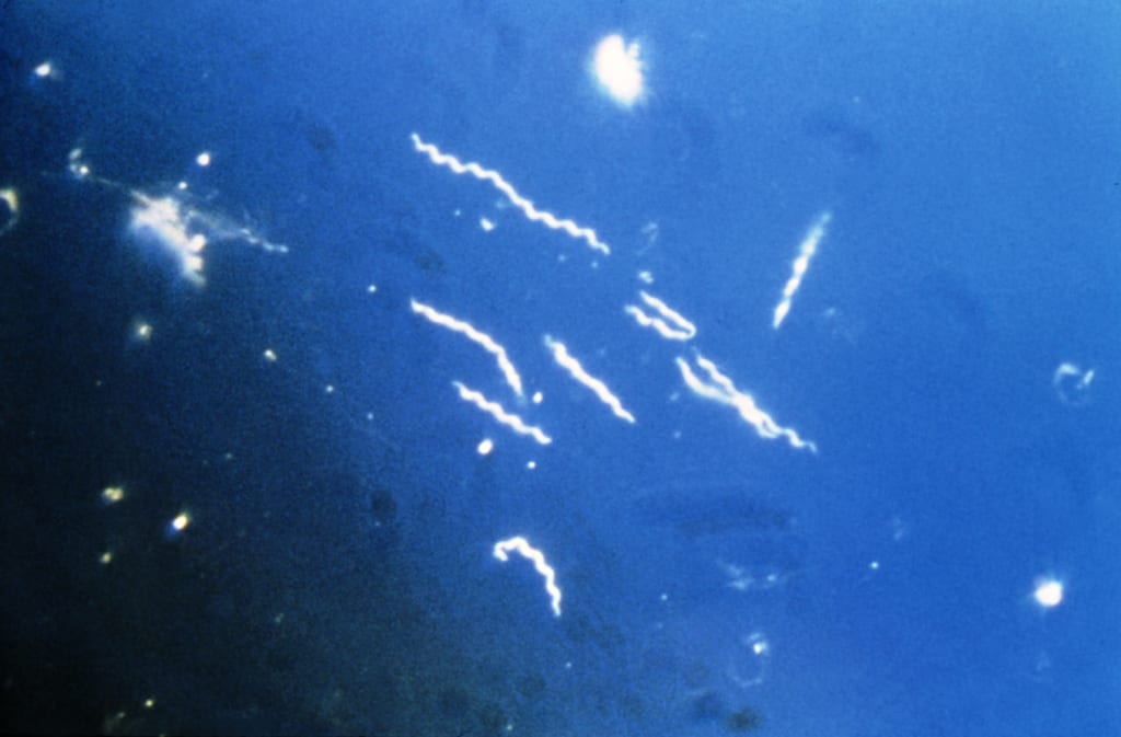 Lyme spirochete, Borrelia burgdorferi