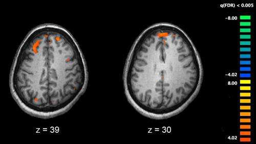 schizophrenia and Bartonella