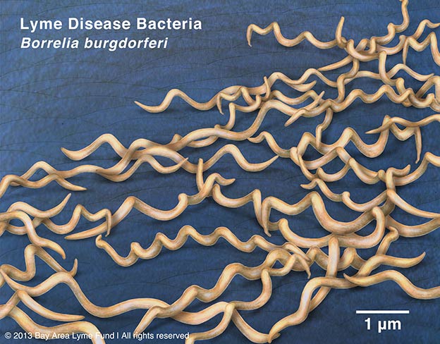 borrelia-burgdorferi